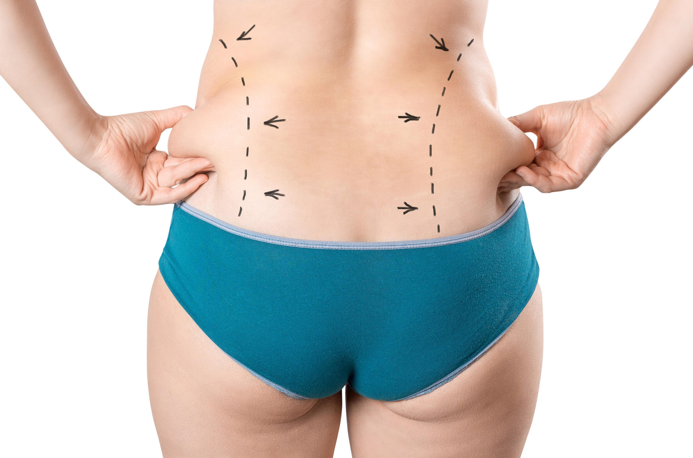 Mommy Makeover Surgery